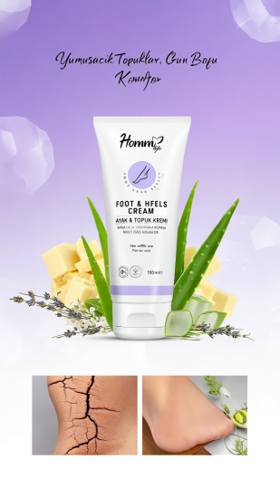 HOMM LIFE Ayak & Topuk Kremi 100 ml | Yumuşacık Topuklar